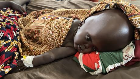 Baby Nyandit - in hospital in Tonj