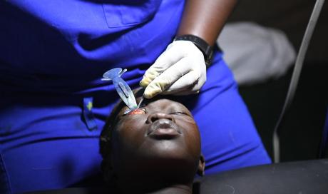 A young girl undergoes surgery for Trachoma performed by Dr Aja Paul